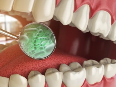 A close-up of teeth with a magnified view of bacteria, illustrating the importance of oral hygiene and dental care.